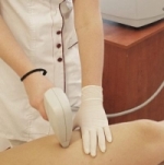 Depilacja laserowa Sopot